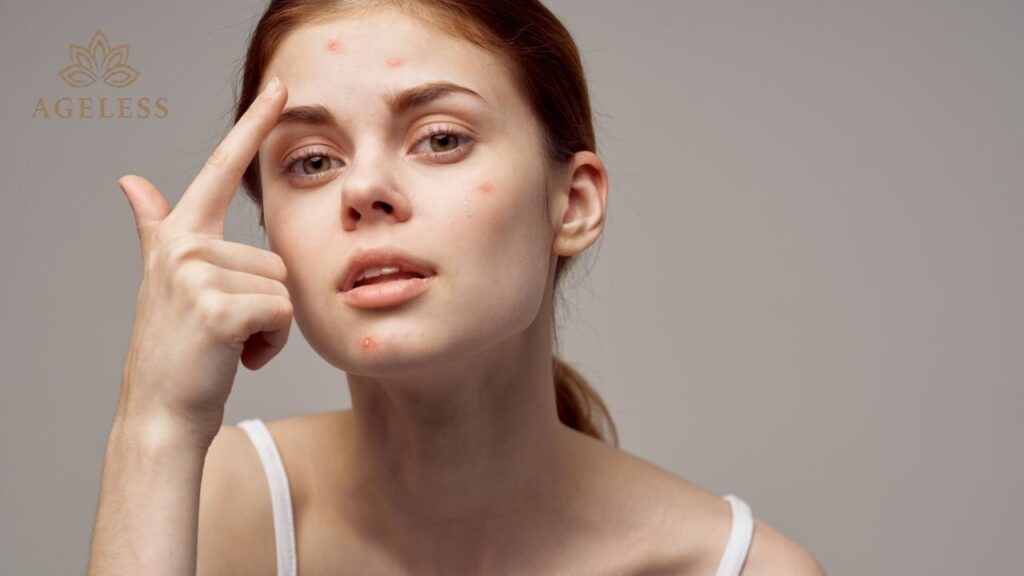 Laser therapy session targeting inflamed papules and pustules
