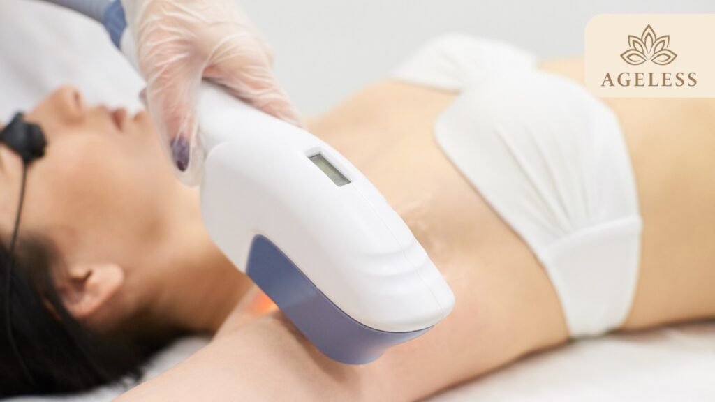 Full Body Laser Hair Removal in Tirupati