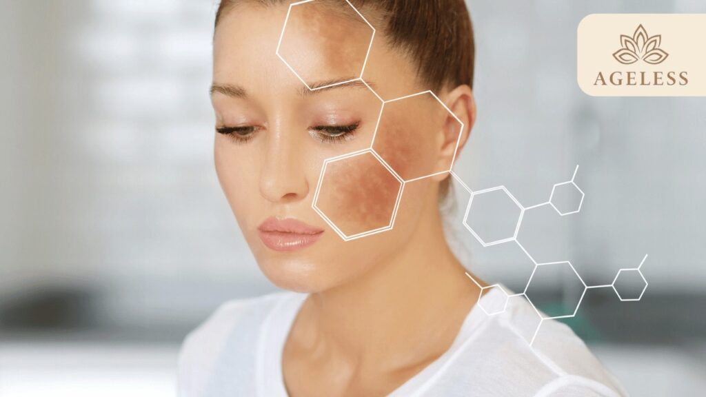 Best Melasma Treatment in Tirupati
