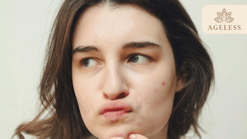 Best Pimple Treatment in Tirupati