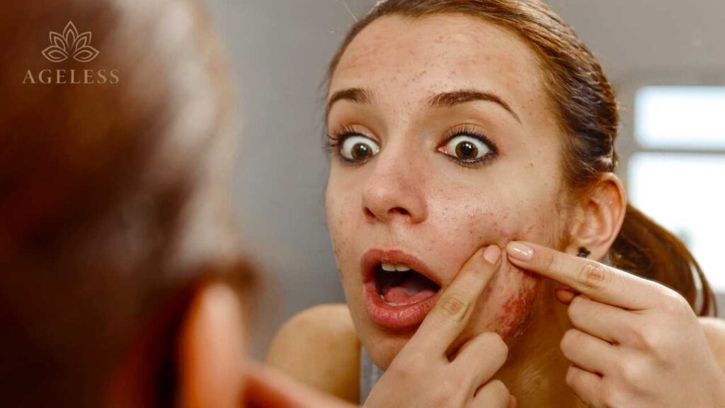 Are All Pimples the Same? How Different Acne Types Need Different Treatments